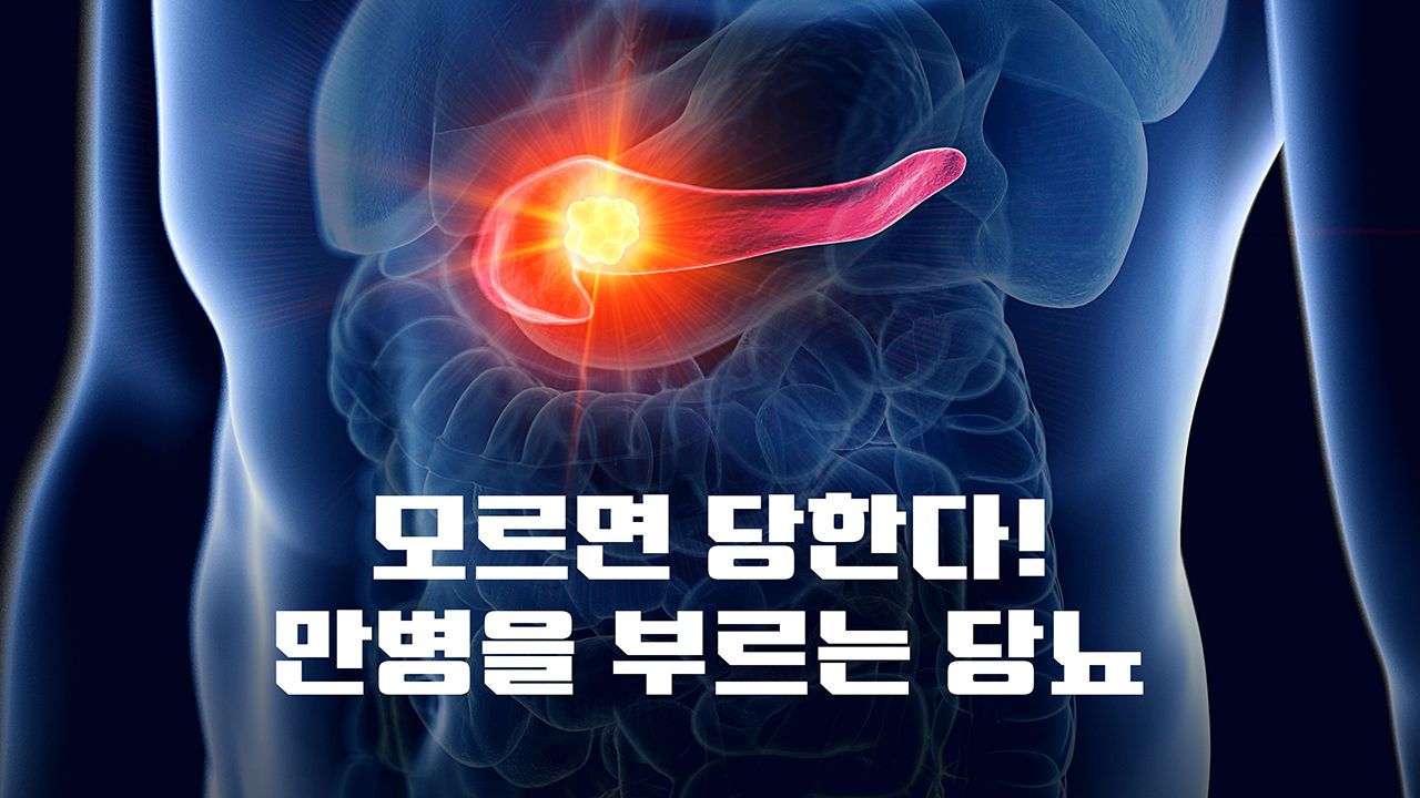특별기획 모르면 당한다! 만병을 부르는 당뇨