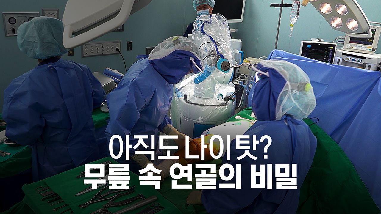 채널A 특별기획 아직도 나이 탓? 무릎 속 연골의 비밀