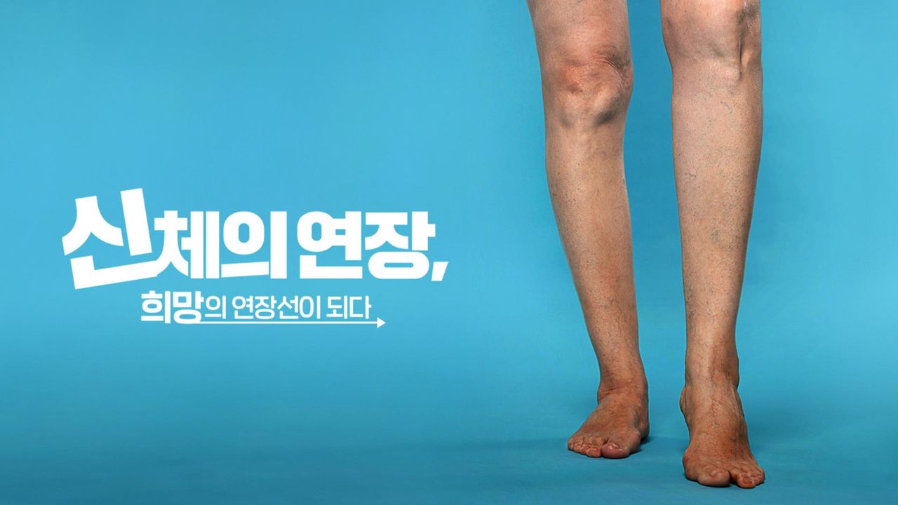 신체의 연장, 희망의 연장선이 되다
