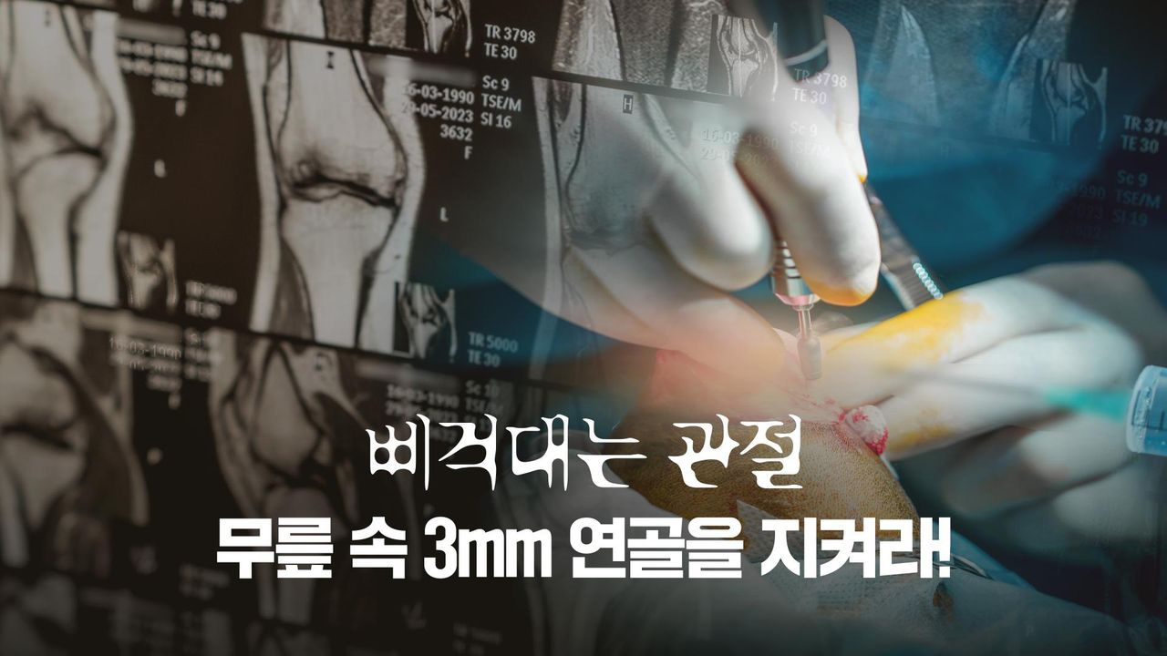 특별기획 삐걱대는 관절, 무릎 속 3mm 연골을 지켜라