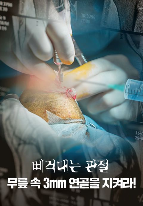 특별기획 삐걱대는 관절, 무릎 속 3mm 연골을 지켜라